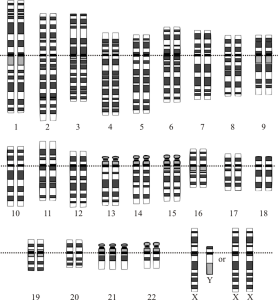 What Down's syndrome looks like at the chromosomal level