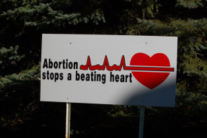 Abortion stops a beating heart. So does capital punishment. But at least capital punishment does not happen without due process of law.