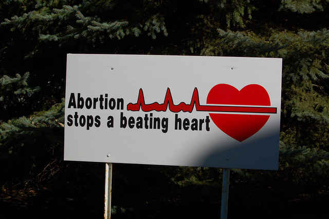 Abortion stops a beating heart - metaphor for the Texas Heartbeat Act