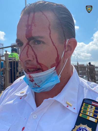 Injured NYPD officer. Roger Stone never did anything like this to anyone.