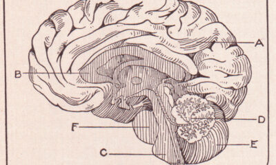 Human brain, sagittal section, looking at right half