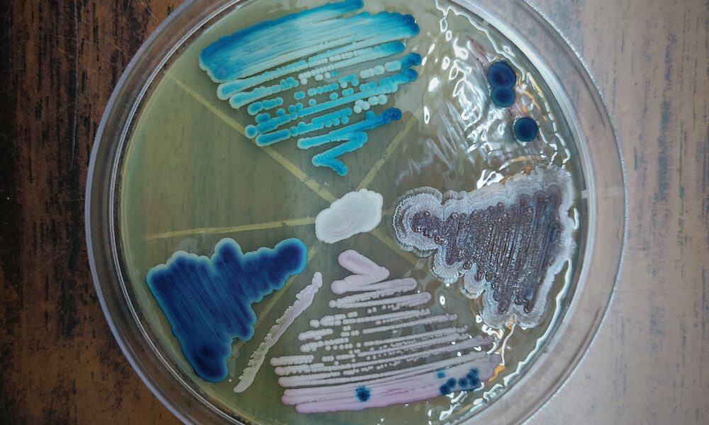 An example of what clinical scientists do - Candida albicans cultured six different ways