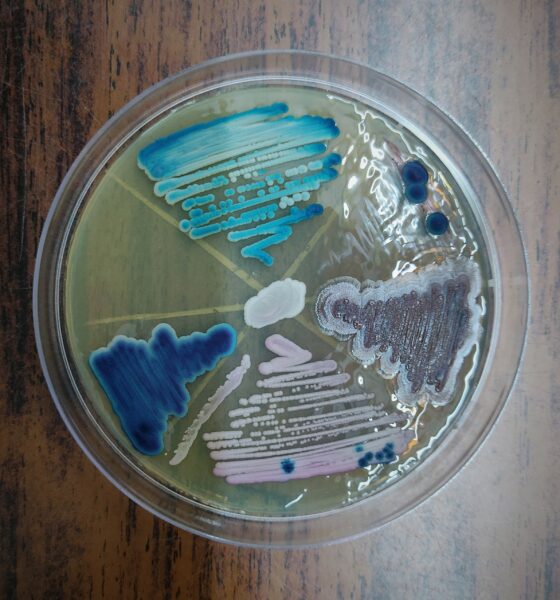 An example of what clinical scientists do - Candida albicans cultured six different ways