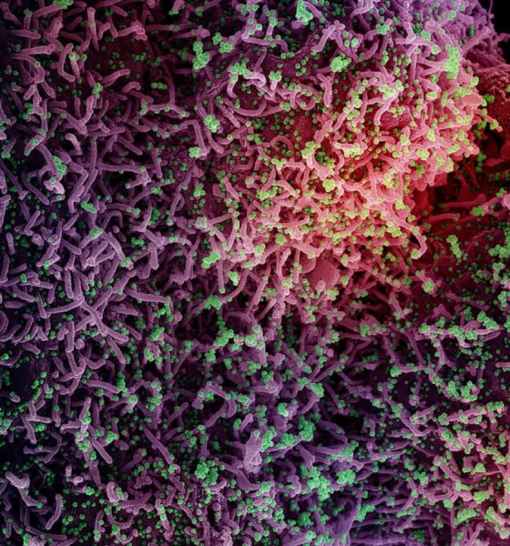 A colored electron micrograph of SARS-CoV-2, the agent of COVID (Corona Virua Disease)